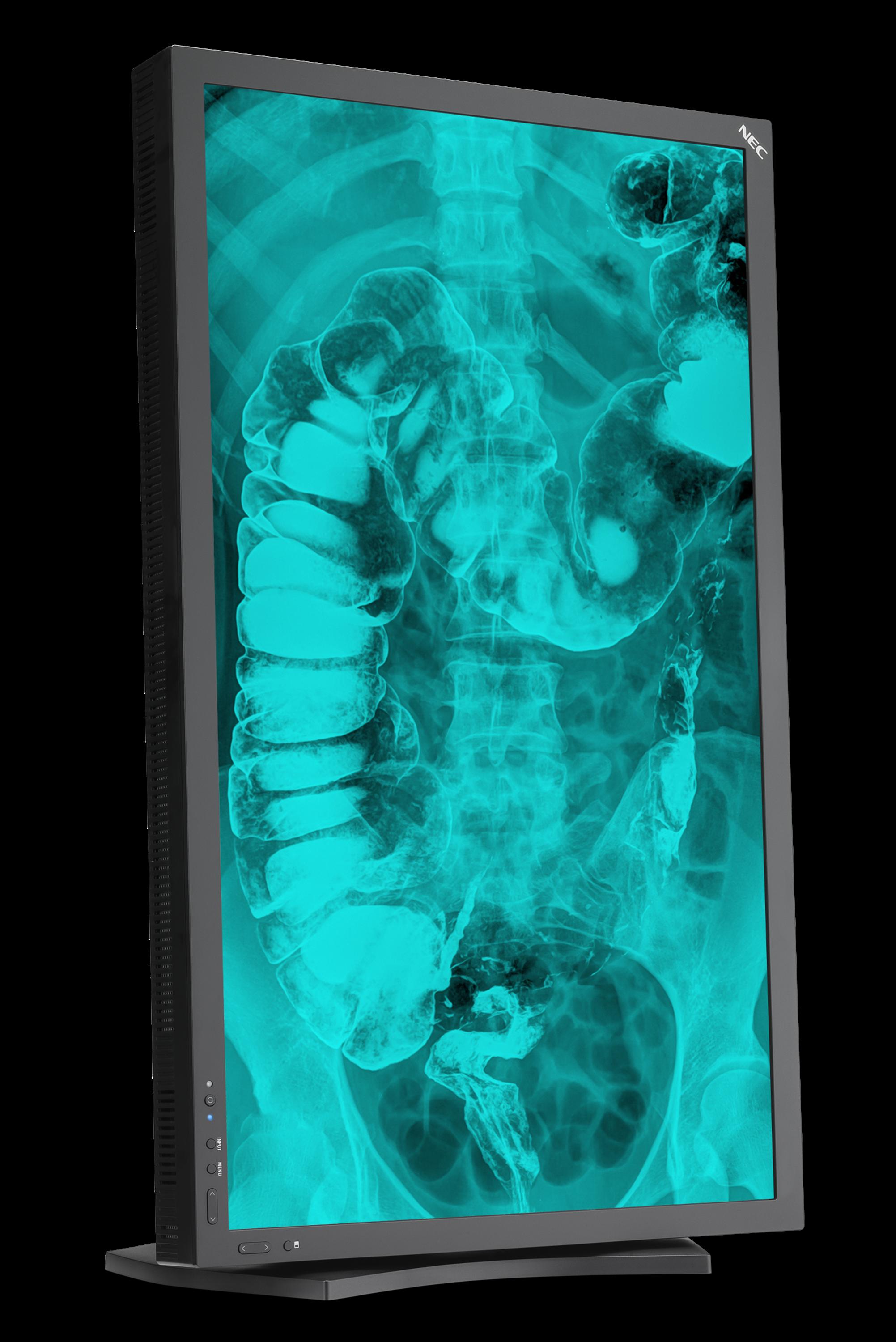 NEC Display Solutions Receives FDA Clearance for MD322C8 Review